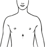 Clavicula-Bandage